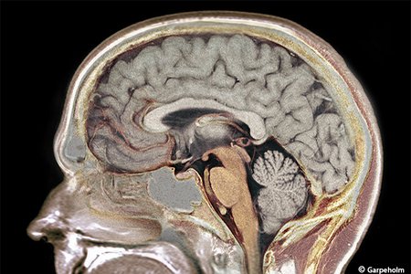 Tomographischer Querschnitt durch Kopf